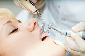 Pleasant Hill Preventative Dentist | teeth cleaning  | Diablo Valley Dentistry