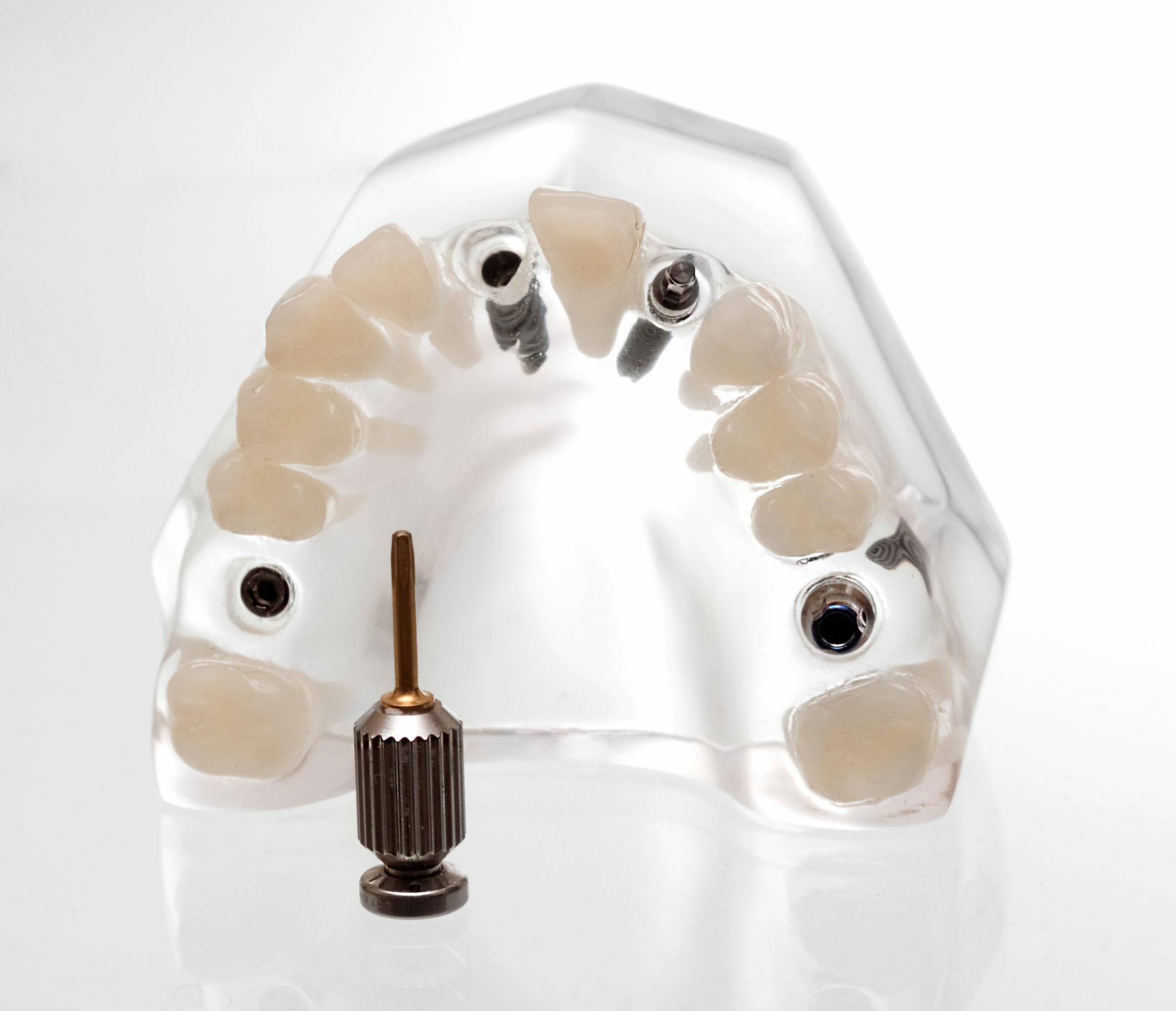  Pleasant Hill Cosmetic Restorative Dentist | dental implants  | Diablo Valley Dentistry