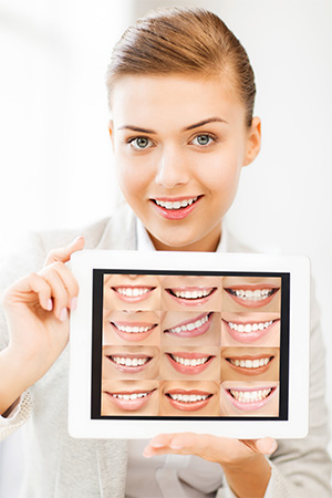  Pleasant Hill Cosmetic Dentist | smile makeover | Diablo Valley Dentistry